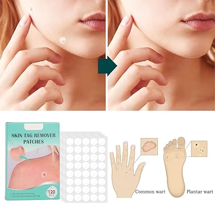 Parches Eliminación de Lunares - additional image 10